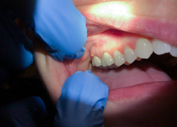 Best Tooth Pain Emergency Relief  in Kalida, OH